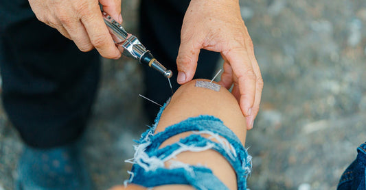 Genouillère tendinite : comment soulager la douleur et favoriser la récupération : Guide complet avec conseils d'experts et tendances