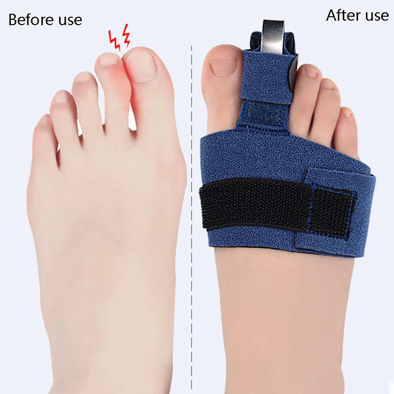 Orthèse doigt de pied Performance